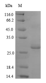 (Tris-Glycine gel) Discontinuous SDS-PAGE (reduced) with 5% enrichment gel and 15% separation gel.